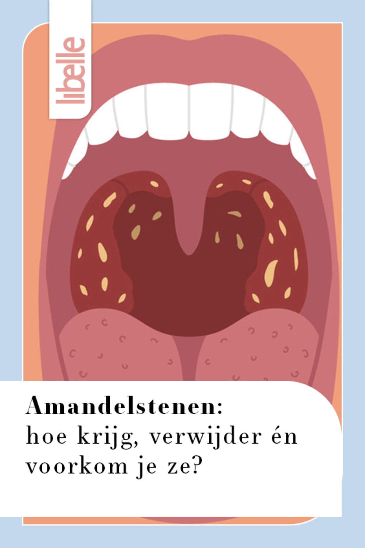 Hoe Ziet Een Amandel Eruit Een Gedetailleerde Verkenning